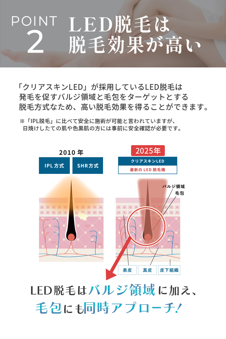 脱毛効果が高い